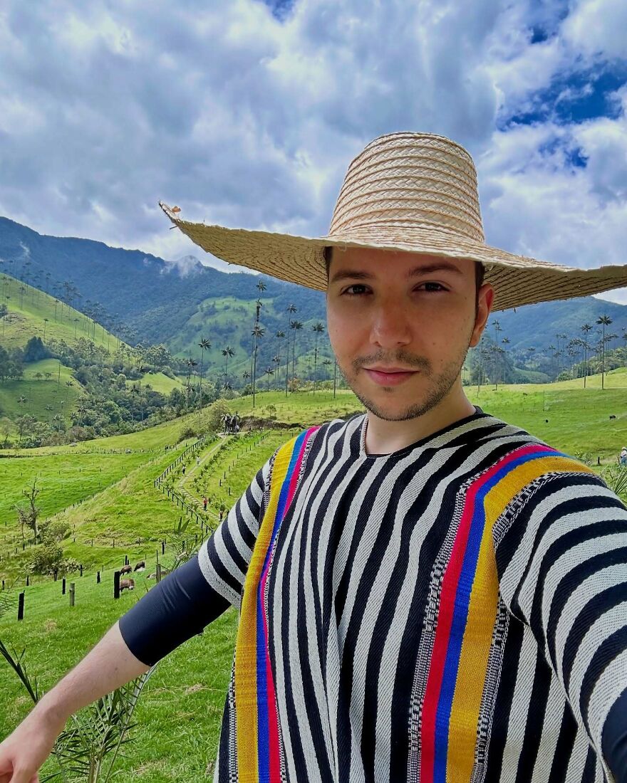 Nikocado Avocado wearing a wide-brimmed hat and striped colorful shirt in a green mountainous landscape, Nikocado Avocado cosmetic surgery results. Nikocado Avocado wearing a wide-brimmed hat and striped colorful shirt in a green mountainous landscape, Nikocado Avocado cosmetic surgery results.
