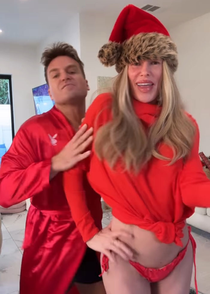 Brandi Glanville posing confidently in a red bikini and Santa hat after face disfigurement diagnosis and psychosis on display. Brandi Glanville posing confidently in a red bikini and Santa hat after face disfigurement diagnosis and psychosis on display.