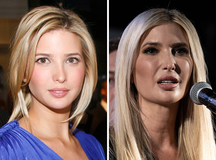 Before and after Mar-a-Lago face transformations showing stunning changes in appearance and style under different lighting conditions.