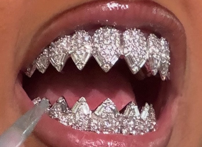 Close-up of diamond-studded grillz on teeth, illustrating North West's controversial new look sparking divided reactions.