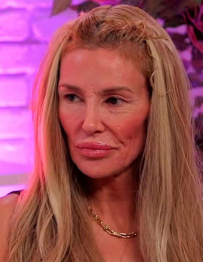 Brandi Glanville with long blonde hair and gold chain necklace after face disfigurement diagnosis in a bold look. Brandi Glanville with long blonde hair and gold chain necklace after face disfigurement diagnosis in a bold look.