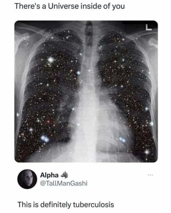 X-ray image of lungs filled with stars and galaxies, humorous post from Mother of Sarcasm showing collective brain cell humor.