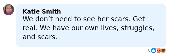 Commenter Katie Smith expressing frustration over visible mastectomy scars in an online discussion about Angelina Jolie.