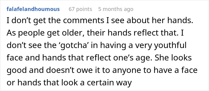 Comment text on a white background discussing aging hands and youthful face appearance in relation to Kris Jenner’s facelift. Comment text on a white background discussing aging hands and youthful face appearance in relation to Kris Jenner’s facelift.
