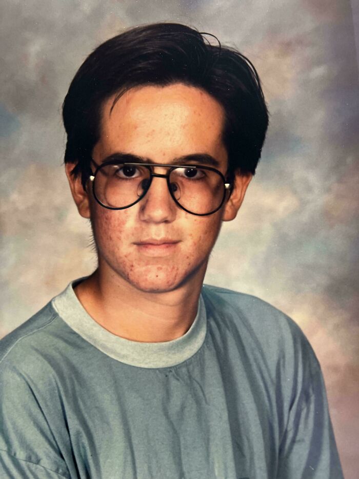 Teenage boy with glasses and acne wearing a blue shirt in a hilariously awkward childhood photo.