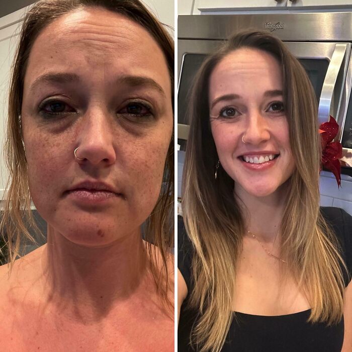Before and after photos showing a woman’s transformation after taking a leap of faith and making a life-changing decision.