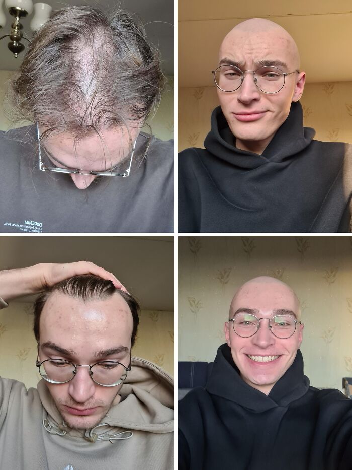 Before and after photos of a man taking a leap of faith by shaving his head, showcasing confident life decisions.