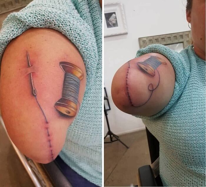 Close-up of a wholesome tattoo with a needle and thread design symbolizing healing on an amputated arm. Close-up of a wholesome tattoo with a needle and thread design symbolizing healing on an amputated arm.