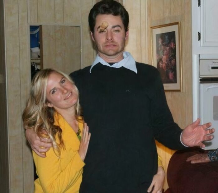Man with a nut perfectly stuck on his face while posing with a smiling woman in a funny, interesting and weird perfect timing pic.