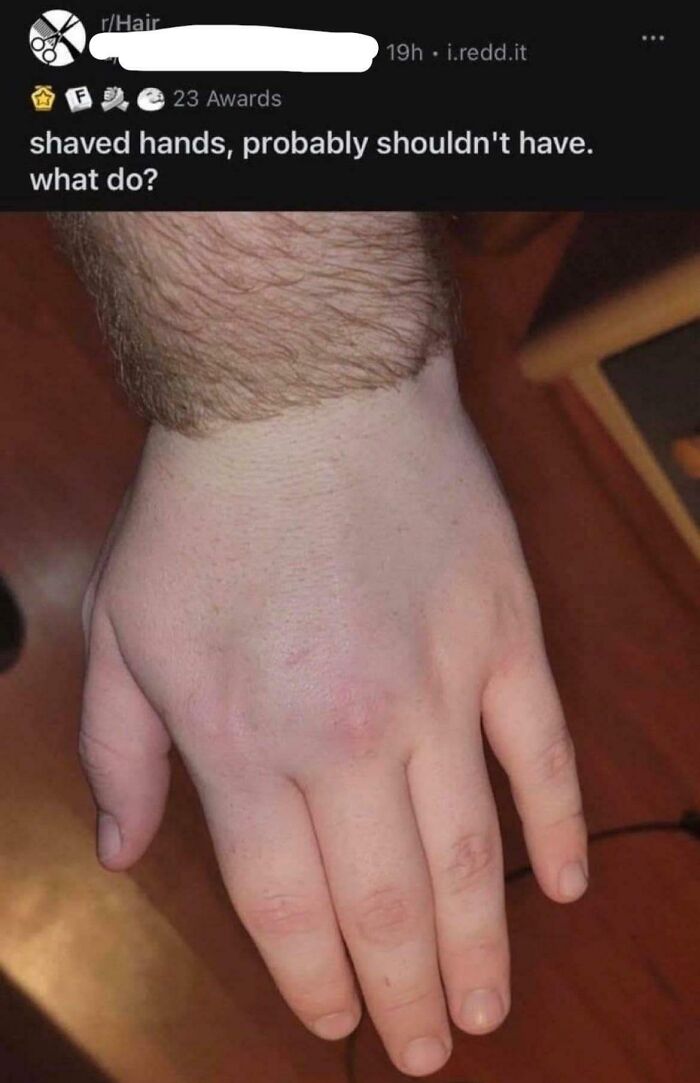 Shaved hands shown with hair only on the wrist, a humorous post from hilarious posts meant to make you laugh.
