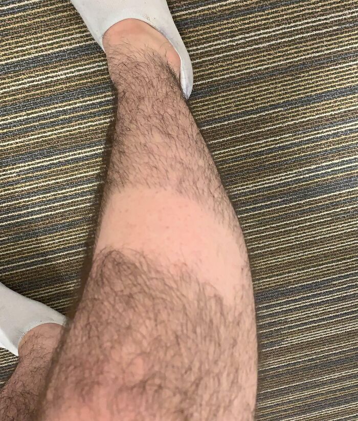 Leg with a sharp tan line from wearing socks, an example of hilariously bad Secret Santa gifts people have received.