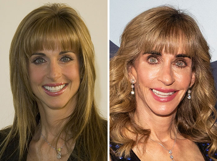 Before and after Mar-a-Lago face transformations showing dramatic changes in facial features and expressions. Before and after Mar-a-Lago face transformations showing dramatic changes in facial features and expressions.