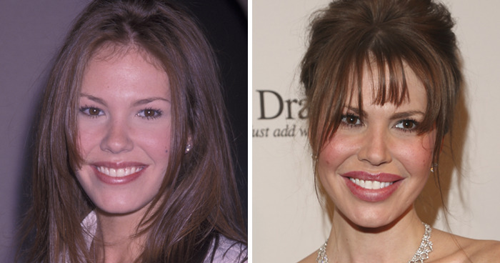 Side-by-side images of a female celebrity before and after plastic surgery, highlighting celebrity plastic surgery effects.