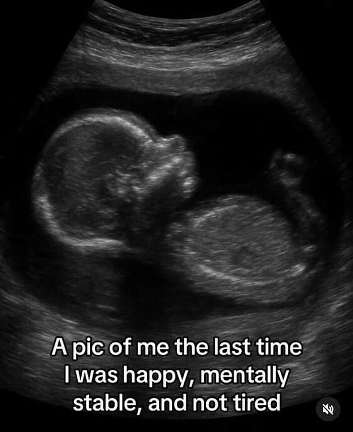 Ultrasound image showing a fetus with a humorous caption, part of memes to help handle reality with humor.