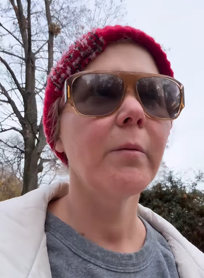Amy Schumer outdoors wearing sunglasses and a red hat, discussed by plastic surgeon on wrinkle-free photos.