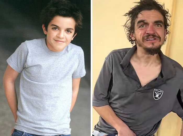 Side-by-side photos showing Tylor Chase before and after hospitalization, highlighting his health decline revealed by a friend. Side-by-side photos showing Tylor Chase before and after hospitalization, highlighting his health decline revealed by a friend.