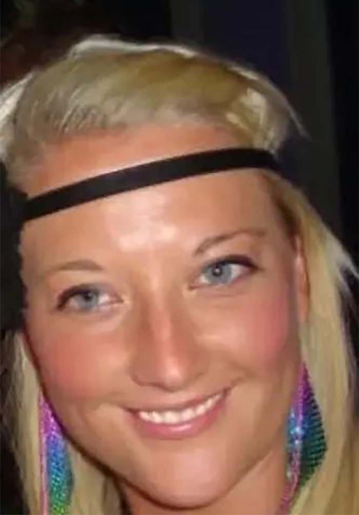 Smiling woman with blonde hair and colorful earrings, showcasing veneers, discussing nose collapsed after procedure in Turkey.