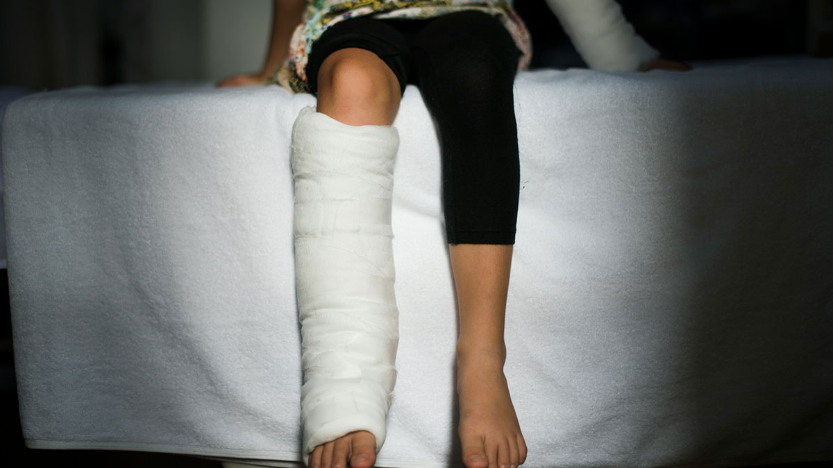Child sitting on a bed with a leg cast, illustrating an example of instant karma and consequences of actions.