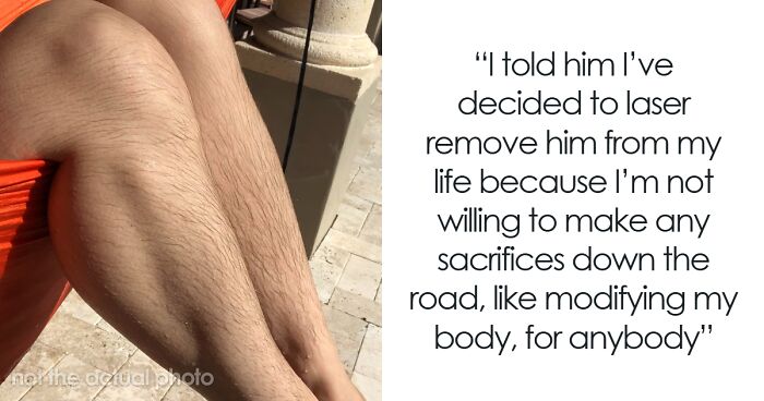 “It Disgusts Him To Look At It”: BF Demands GF Laser Off All Body Hair, Gets Destroyed Online