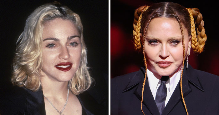 20 Celebrities Who Learned The Hard Way About Plastic Surgery