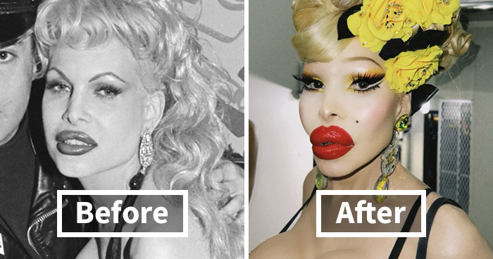 20 Celebrities Who Learned The Hard Way About Plastic Surgery