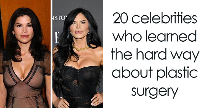 20 Celebrities Who Learned The Hard Way About Plastic Surgery