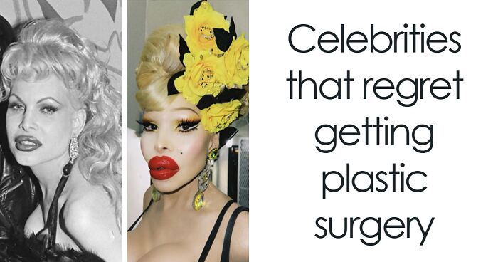 20 Celebrities Who Learned The Hard Way About Plastic Surgery