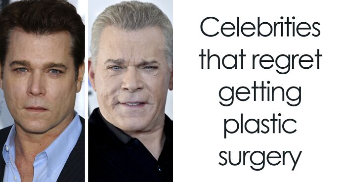 20 Celebrities Who Learned The Hard Way About Plastic Surgery
