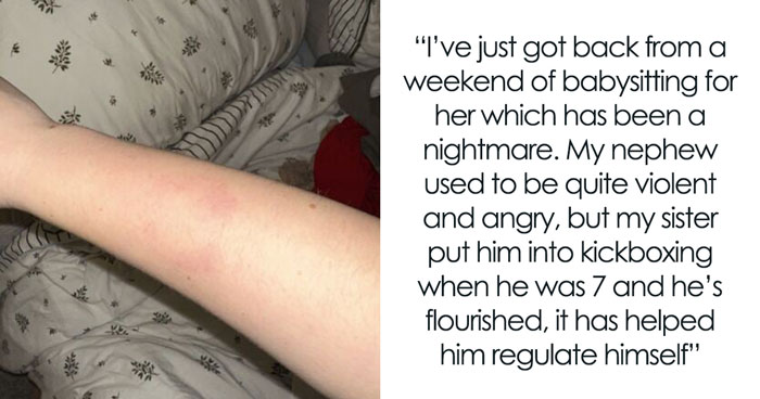 Woman Gets Bitten By Autistic Nephew, Refuses To Babysit After Sis Says She Won’t Discipline Him
