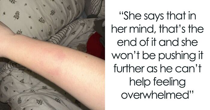 Woman Gets Bitten By Autistic Nephew, Refuses To Babysit After Sis Says She Won’t Discipline Him