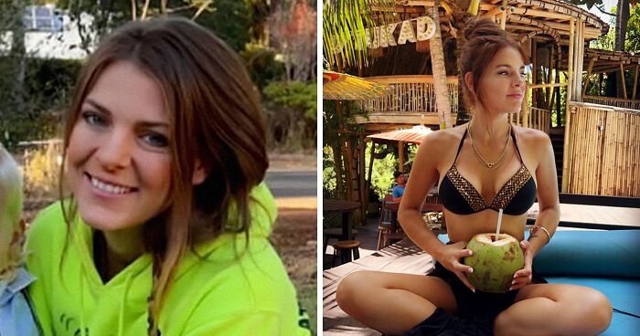 Mom, 31, On Life Support After Traveling To Vietnam For Plastic Surgery