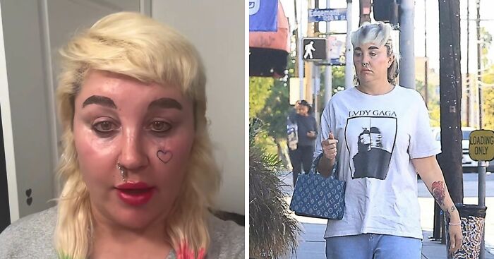 Amanda Bynes Opens Up About Using Injections After Paparazzi Pic Shows Dramatic Weight Loss