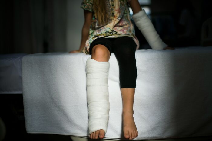 Child sitting on a bed with arm and leg in casts, illustrating an example of instant karma and consequences.