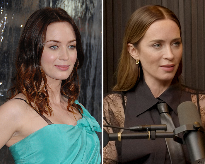 Emily Blunt speaking during a podcast appearance, sparking plastic surgery rumors and public surgeon concerns. Emily Blunt speaking during a podcast appearance, sparking plastic surgery rumors and public surgeon concerns.