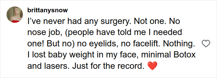 Alt text: Brittany Snow’s blunt response to plastic surgery rumors denying nose jobs and facelifts amid netizens’ comments on noses. Alt text: Brittany Snow’s blunt response to plastic surgery rumors denying nose jobs and facelifts amid netizens’ comments on noses.