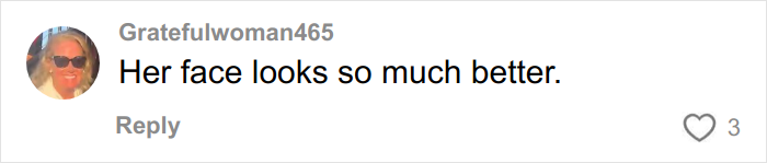 Comment from user Gratefulwoman465 praising Amy Schumer’s wrinkle-free photos, related to plastic surgeon’s professional perspective.