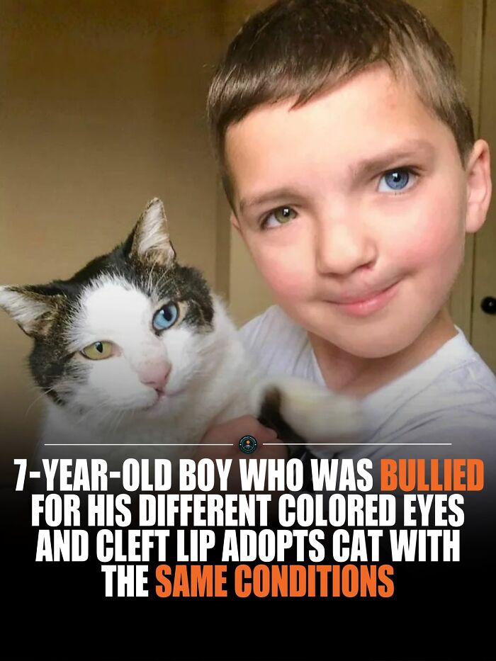 Boy with different colored eyes and cleft lip holding a cat with similar conditions, sharing knowledge and unique facts.