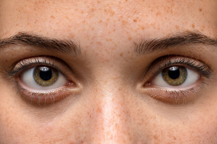 Close-up of human eyes and skin showing unique human body features and natural freckles in high detail.