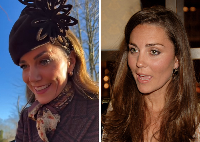 Kate Middleton outdoors wearing hat with floral decoration, showing facial scar fueling 2024 hospitalization rumors.