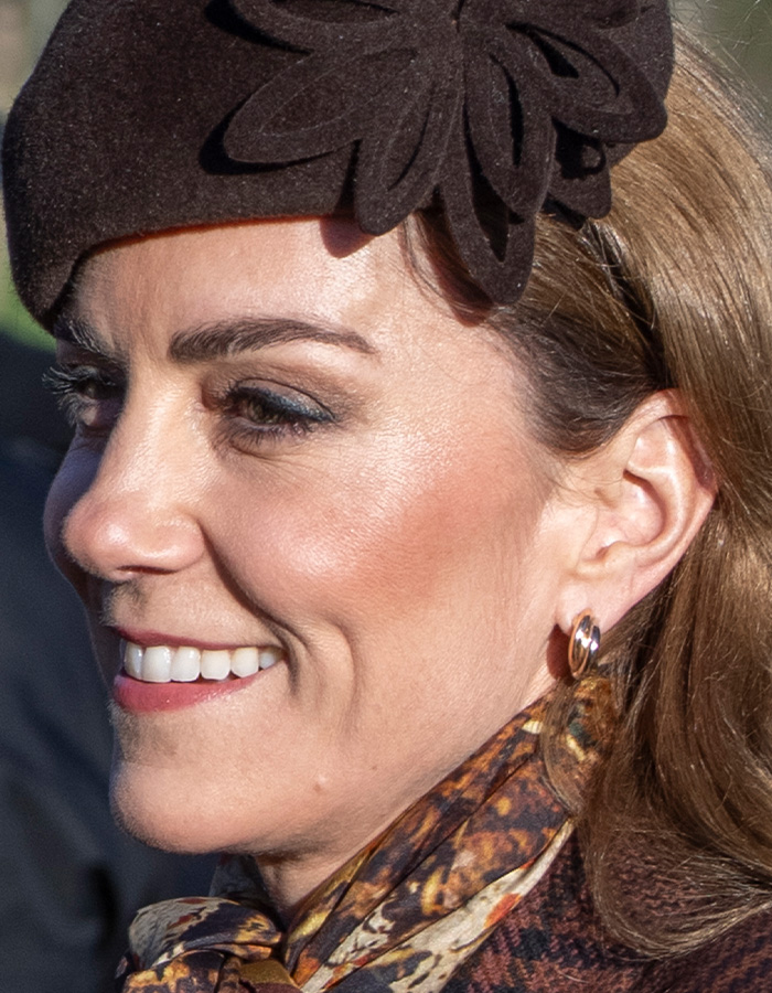Close-up of Kate Middleton&rsquo;s face showing a faint facial scar amid rumors about her 2024 hospitalization seriousness.