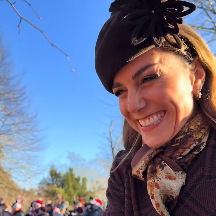Kate Middleton smiling outdoors wearing a brown hat and scarf with visible facial scar in natural light.