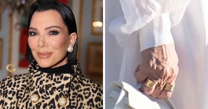 “The Hands Never Lie”: Kris Jenner Finally Ditches Gloves In Public After Viral $100k Facelift