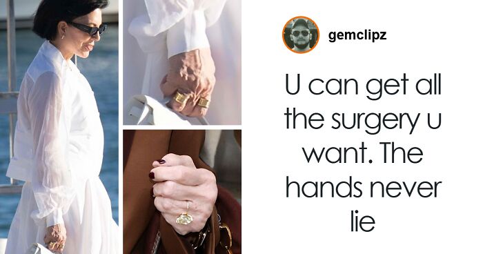 10 “Mar-a-Lago” Face Transformations That Left People Utterly Stunned