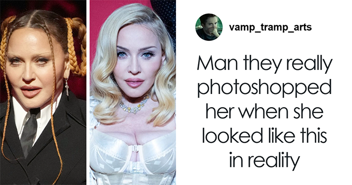 “They Really Photoshopped Her”: Madonna’s Holiday Lingerie Photoshoot Sparks Frenzy