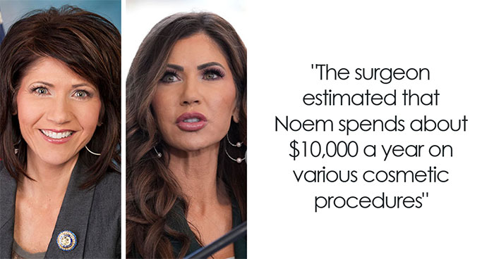 10 “Mar-a-Lago” Face Transformations That Left People Utterly Stunned