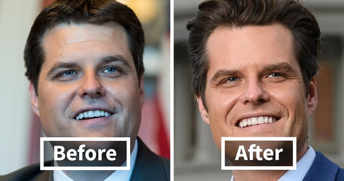 10 “Mar-a-Lago” Face Transformations That Left People Utterly Stunned