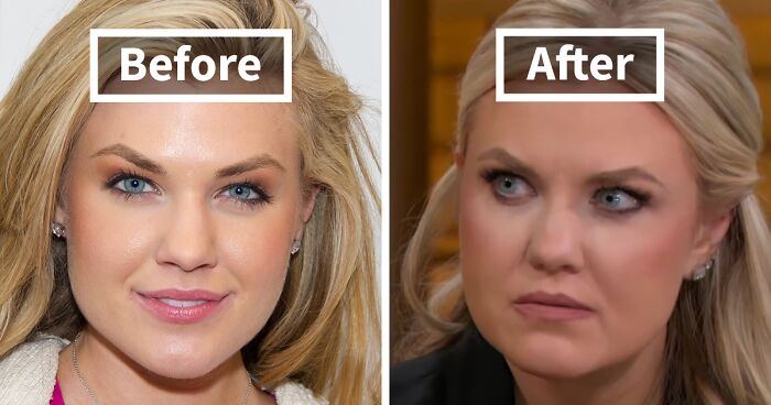 10 “Mar-a-Lago” Face Transformations That Left People Utterly Stunned