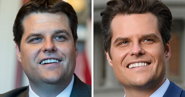 10 “Mar-a-Lago” Face Transformations That Left People Utterly Stunned