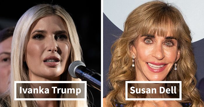 10 “Mar-a-Lago” Face Transformations That Left People Utterly Stunned