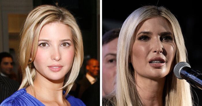 10 “Mar-a-Lago” Face Transformations That Left People Utterly Stunned